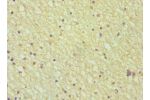 Immunohistochemistry of paraffin-embedded human brain using CSB-PA001683DSR1HU at dilution 1:100