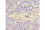 Immunohistochemistry of paraffin-embedded human pancreatic tissue using CSB-PA001685LA01HU at dilution of 1:100