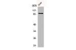 Western Blot analysis of LOVO cells using CLC-7 Polyclonal Antibody