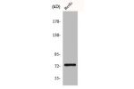 Western Blot analysis of HuvEc cells using CLC-KA Polyclonal Antibody