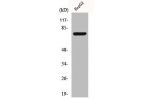 Western Blot analysis of Jurkat cells using CLIP4 Polyclonal Antibody