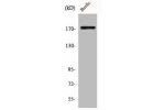 Western Blot analysis of HuvEc cells using COL11A2 Polyclonal Antibody