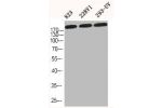 Western Blot analysis of 823 22RV1 293-UV cells using COL1A2 Polyclonal Antibody