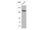 Western Blot analysis of COLO205 cells using COL2A1 Polyclonal Antibody