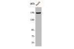 Western Blot analysis of K562 cells using COL4A6 Polyclonal Antibody