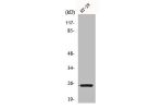 Western Blot analysis of HT29 cells using Connexin 25 Polyclonal Antibody