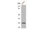 Western Blot analysis of Jurkat cells using Connexin-26 Polyclonal Antibody