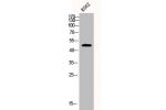 Western Blot analysis of K562 cells using CPA1 Polyclonal Antibody