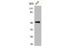 Western Blot analysis of A549 cells using CPM Polyclonal Antibody