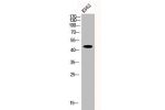 Western Blot analysis of K562 cells using CRF-RII Polyclonal Antibody