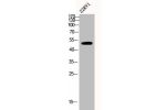 Western Blot analysis of 22RV1 cells using Csk Polyclonal Antibody