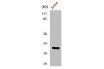 Western Blot analysis of LOVO cells using CSP Polyclonal Antibody