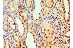 Immunohistochemistry of paraffin-embedded human kidney using CSB-PA001822ESR2HU at dilution 1:100