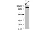 Western Blot<br />
Positive WB detected in:Mouse kidney tissue<br />
All lanes:ANPEP antibody at 3.4