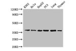 Western Blot<br />
Positive WB detected in:K562 whole cell lysate,Hela whole cell lysate,HepG2 whole cell lysate,PC3 whole cell lysate,Mouse lung tissue,Mouse thymus tissue<br />
All lanes: Anxa1 antibody at 5