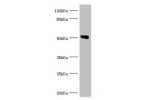 All lanes:Annexin A11 antibody at 14ug/ml<br />
Lane 1:Hela whole cell lysate<br />
Lane 2:A431 whole cell lysate<br />
Lane 3:U251 whole cell lysate<br />
Secondary<br />
Goat polyclonal to rabbit at 1/10000 dilution<br />
Predicted band size: 55,52 kDa<