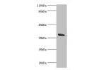 Western blot<br />
All lanes:Annexin A2 antibody at 2ug/ml+Hela whole cell lysate<br />
Secondary<br />
Goat polyclonal to rabbit at 1/10000 dilution<br />
Predicted band size: 39,41 kDa<br />
Observed band size: 39 kDa<br />