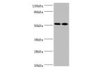 All lanes:Annexin A7 antibody at 4ug/ml<br />
Lane 1:mouse heart tissue<br />
Lane 2:jurkat whole cell lysate<br />
Lane 3:LO2 whole cell lysate<br />
Secondary<br />
Goat polyclonal to rabbit at 1/10000 dilution<br />
Predicted band size: 53,51 kDa<br />