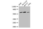 Western Blot<br />
Positive WB detected in:A549 whole cell lysate,Mouse skeletal muscle tissue,Rat lung tissue<br />
All lanes:AOAH antibody at 2.5