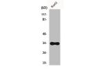 Western Blot analysis of K562 cells using CYB5R3 Polyclonal Antibody