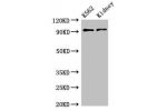 Western Blot<br />
Positive WB detected in:K562 whole cell lysate,Mouse kidney tissue<br />
All lanes:AP1G1 antibody at 3.4