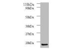Western blot<br />
All lanes: AP-1 complex subunit sigma-3 antibody at 2ug/ml+A549 whole cell lysate<br />
Secondary<br />
Goat polyclonal to Rabbit IgG at 1/10000 dilution<br />
Predicted band size: 19,20,13 kDa<br />
Observed band size: 18 kDa<br />