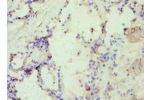 Immunohistochemistry of paraffin-embedded human prostate using CSB-PA001869ESR1HU at dilution 1:100