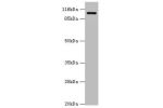 Western blot<br />
All lanes:AP2A2 antibody at 0.61ug/ml+mouse brain tissue<br />
Secondary<br />
Goat polyclonal to rabbit at 1/10000 dilution<br />
Predicted band size: 104,105,74 kDa<br />
Observed band size: 104 kDa<br />
