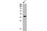 Western Blot analysis of MCF-7 cells using Cyclin D1 Polyclonal Antibody