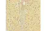 Immunohistochemistry of paraffin-embedded human adrenal gland tissue using CSB-PA001878LA01HU at dilution of 1:100