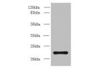 Western blot<br />
All lanes: AP3S2 antibody at 6ug/ml+ A549 whole cell lysate<br />
Goat polyclonal to rabbit at 1/10000 dilution<br />
Predicted band size: 23,44 kDa<br />
Observed band size: 22 kDa<br />