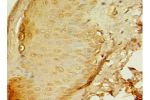 Immunohistochemistry of paraffin-embedded human skin tissue using CSB-PA001885LA01HU at dilution 1:100