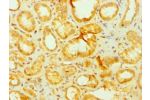 Immunohistochemistry of paraffin-embedded human kidney using CSB-PA001912DSR2HU at dilution 1:100