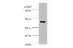 Western blot<br />
All lanes:APOA4 antibody at 2ug/ml+human serumSecondary<br />
Goat polyclonal to rabbit at 1/10000 dilution<br />
Predicted band size: 45kDa<br />
Observed band size: 45kDa<br />