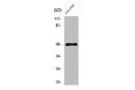 Western Blot analysis of COLO205 cells using CYP11B1/2 Polyclonal Antibody