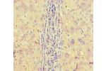 Immunohistochemistry of paraffin-embedded human liver tissue using CSB-PA001926LA01HU at dilution of 1:100