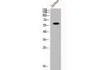 Western Blot analysis of Jurkat cells using CYP1B1 Polyclonal Antibody