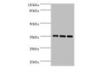 Western blot<br />
All lanes: Apolipoprotein E antibody at 2ug/ml<br />
Lane 1 : mouse lung tissue<br />
Lane 2 : mouse brain tissue<br />
Lane 3 : mouse liver tissue<br />
Secondary<br />
Goat polyclonal to Rabbit IgG at 1/10000 dilution<br />
Predicted 