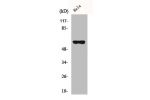 Western Blot analysis of HeLa cells using CYP27A1 Polyclonal Antibody
