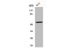Western Blot analysis of A549 cells using CYP2A13 Polyclonal Antibody