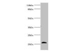 Western blot<br />
All lanes:APOM antibody at 3.93ug/ml+mouse placenta tissue<br />
Secondary<br />
Goat polyclonal to rabbit at 1/10000 dilution<br />
Predicted band size: 22,14 kDa<br />
Observed band size: 21 kDa<br />