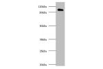 Western blot<br />
All lanes: Amyloid beta A4 protein antibody at 2ug/ml<br />
Lane 1 : HL-60 whole cell lysate<br />
Secondary<br />
Goat polyclonal to Rabbit IgG at 1/10000 dilution<br />
Predicted band size: 87,35,77,79,81,83,85,86,73,84 kDa<br />
Obse