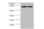 Western blot<br />
All lanes: Amyloid beta A4 protein antibody at 2ug/ml<br />
Lane 1 : HL-60 whole cell lysate<br />
Lane 2 : Mouse kidney tissue<br />
Secondary<br />
Goat polyclonal to Rabbit IgG at 1/10000 dilution<br />
Predicted band size: 87,35,77,