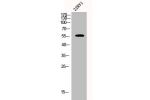 Western Blot analysis of 22RV1 cells using CYP2A7 Polyclonal Antibody