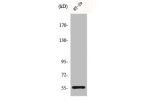 Western Blot analysis of HT29 cells using CYP2B6 Polyclonal Antibody