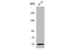 Western Blot analysis of HT29 cells using CYP2D6 Polyclonal Antibody