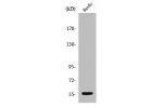 Western Blot analysis of COLO205 cells using CYP2S1 Polyclonal Antibody
