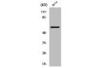Western Blot analysis of LOVO cells using CYP2U1 Polyclonal Antibody