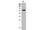 Western Blot analysis of KB cells using CYP3A4 Polyclonal Antibody