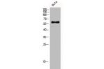 Western Blot analysis of Hela cells using CYP4F2 Polyclonal Antibody